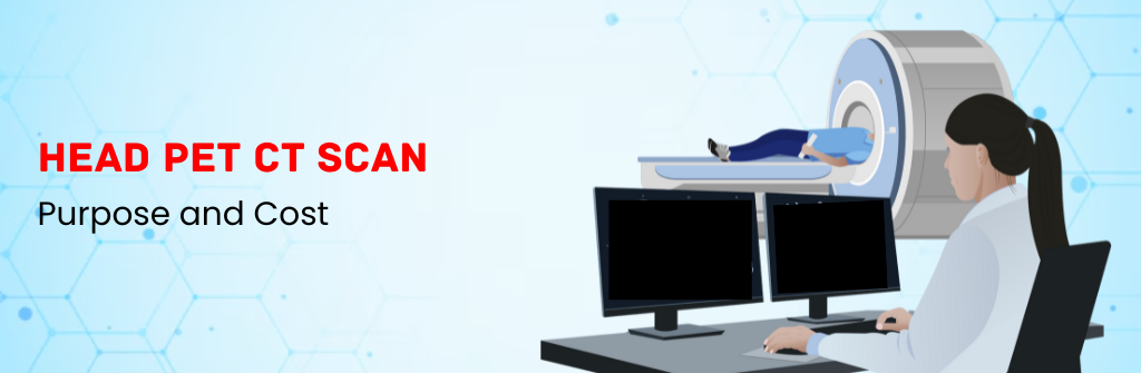 Head PET CT Scan: Purpose and Cost